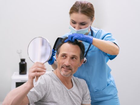 dee0239b adult male getting hair loss treatment 463x348 1