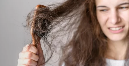 Kadınlarda Saç Dökülmesinin Sebepleri Nelerdir, Nasıl Önlem Alınır?