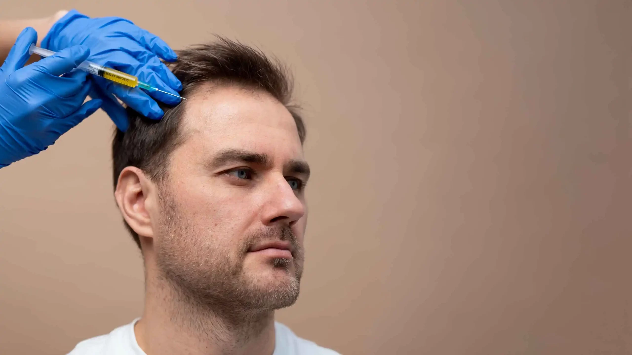 Saç Dökülmesi Tedavisi için Cerrahi Yöntemler Nelerdir?