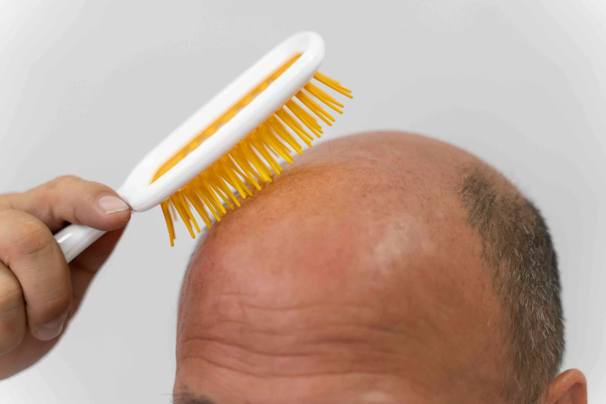Saç Dökülmesine Karşı Ne Tür Şampuanlar Kullanılabilir?